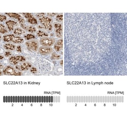 SLC22A13 Antibody, Novus Biologicals:Antibodies:Primary Antibodies